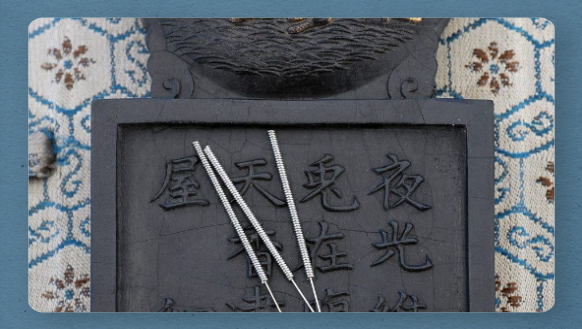 Chinese Acupuncture - Dates back over 1000 years Chiness Acupuncture Needles